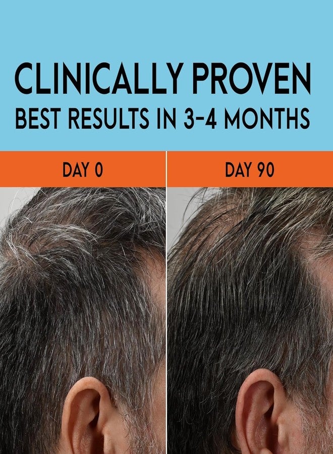Just for Men Gray Reverse Daily Hair Serum, Gradually Reduces Gray Hair, Easy Dye-Free Serum, Travel Friendly, 1.7oz - Image 2